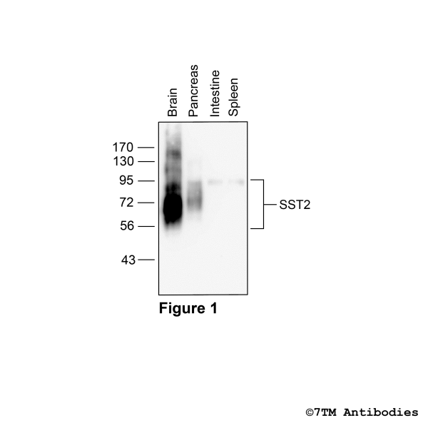 Western blot analysis of Somatostatin Receptor 2 in mouse tissues in vivo