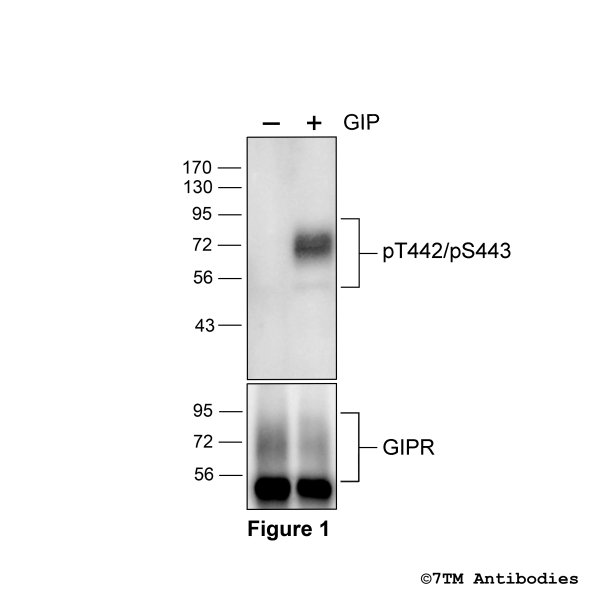 pT442/pS443-GIPR (phospho-Gastric Inhibitory Polypeptide Receptor Antibody)