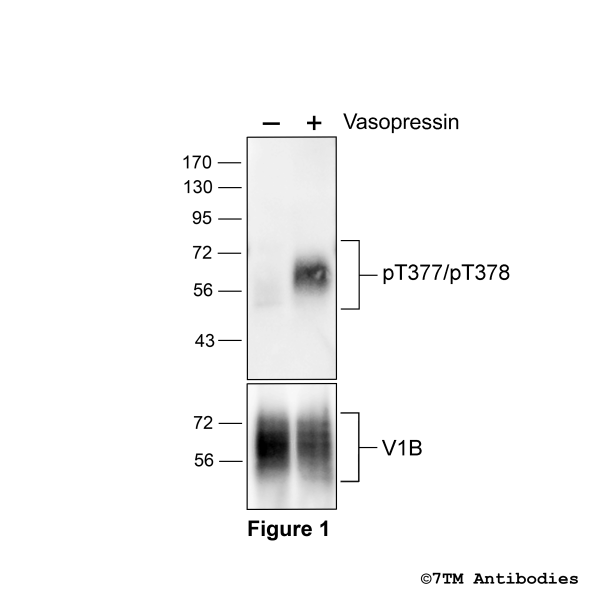 Agonist-induced Threonine377/Threonine378 phosphorylation of the Vasopressin Receptor 1B