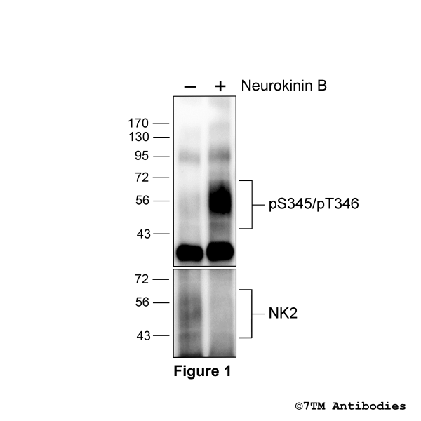 Agonist-induced Serine345/Threonine346 phosphorylation of NK2 Receptor.