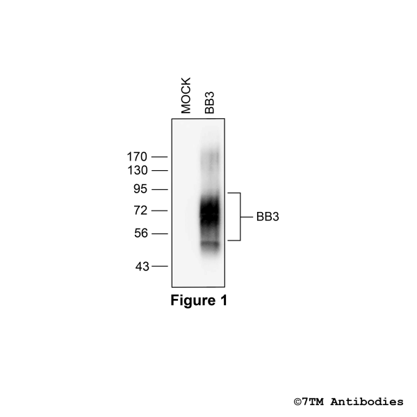Validation of the Bombesin Receptor 3 in transfected HEK293 cells.