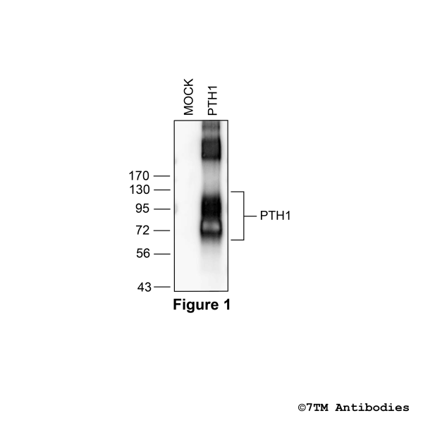 Validation of the Parathyroid Hormone Receptor 1 in transfected HEK293 cells