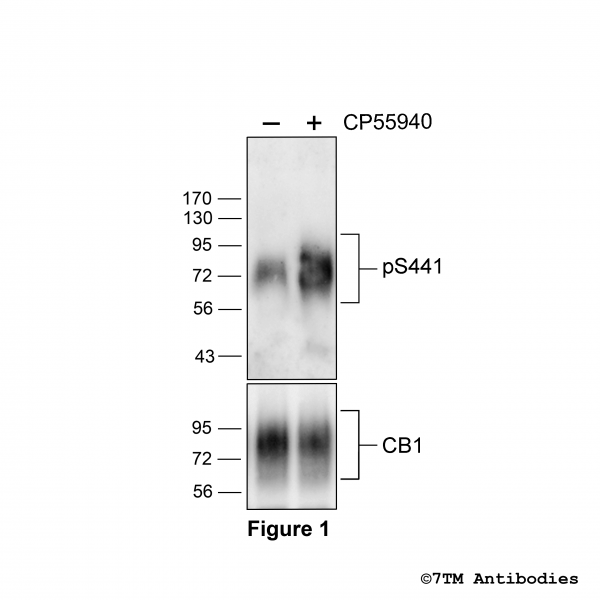 Agonist-induced Serine441 phosphorylation of the Cannabinoid Receptor 1