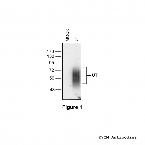 Validation of the Urotensin Receptor in transfected HEK293 cells