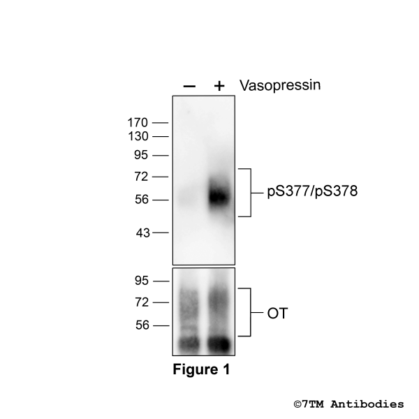 Agonist-induced Serine377/Ser378 phosphorylation of the Oxytocin Receptor.