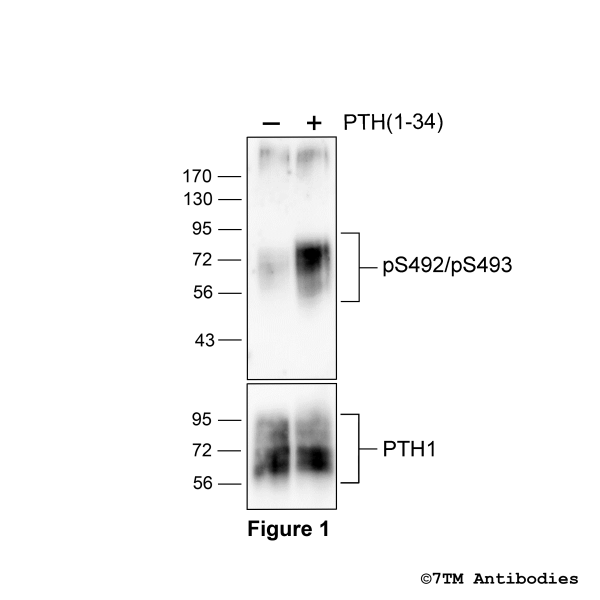 Agonist-induced Serine492/Serine493 phosphorylation of the Parathyroid Hormone Receptor 1