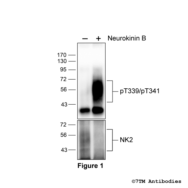 Agonist-induced Threonine339/Threonine341 phosphorylation of NK2 Receptor.