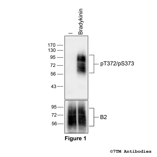 Agonist-induced Threonine372/Serine373 phosphorylation of the Bradykinin Receptor 2