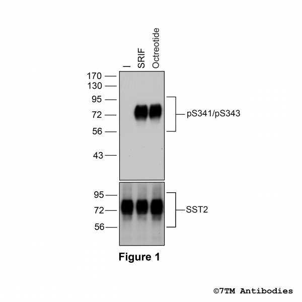 Agonist-induced Serine341/Serine343 phosphorylation of the Somatostatin Receptor 2.