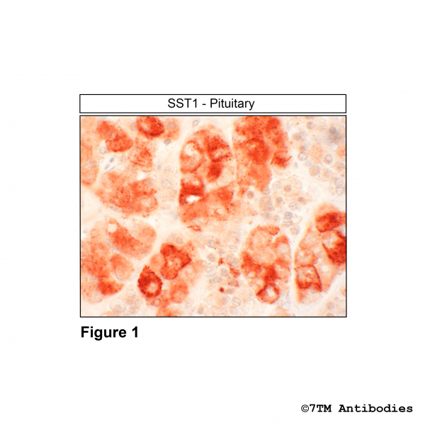 Immunohistochemical identification of Somatostatin Receptor 1 in human pituitary.