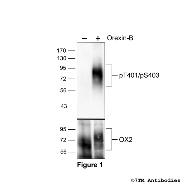 Agonist-induced Threonine401/Serine403 phosphorylation of Orexin Receptor 2
