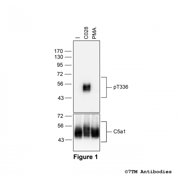 Agonist-induced Threonine336 phosphorylation of the Complement C5a Receptor 1