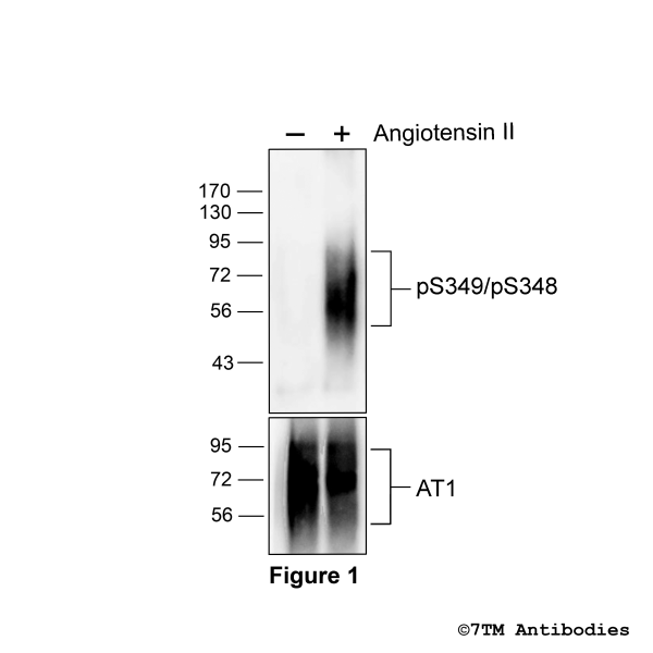 Agonist-induced Serine346/Serine347 phosphorylation of the Angiotensin Receptor 1