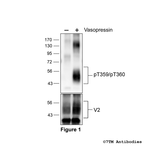Agonist-induced Threonine359/Threonine360 phosphorylation of the Vasopressin Receptor 2.