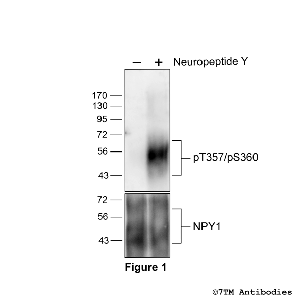 gonist-induced Threonine357/Serine360 phosphorylation of the Neuropeptide Y receptor 1