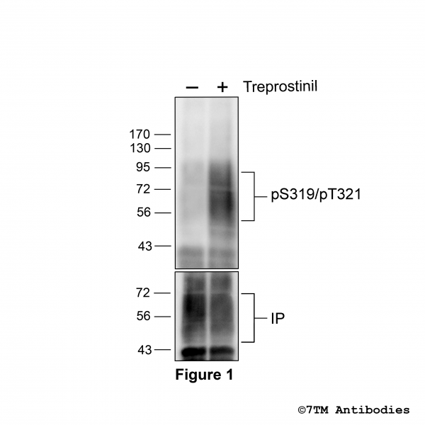 Agonist-induced Serine319/Threonine321 phosphorylation of the IP Prostacyclin Receptor