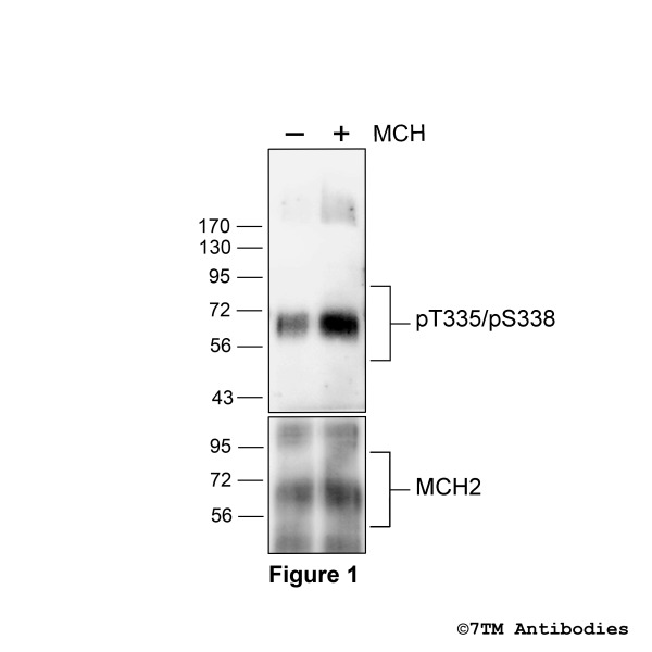 Agonist-induced Threonine335/Serine338 phosphorylation of MCH2 Receptor