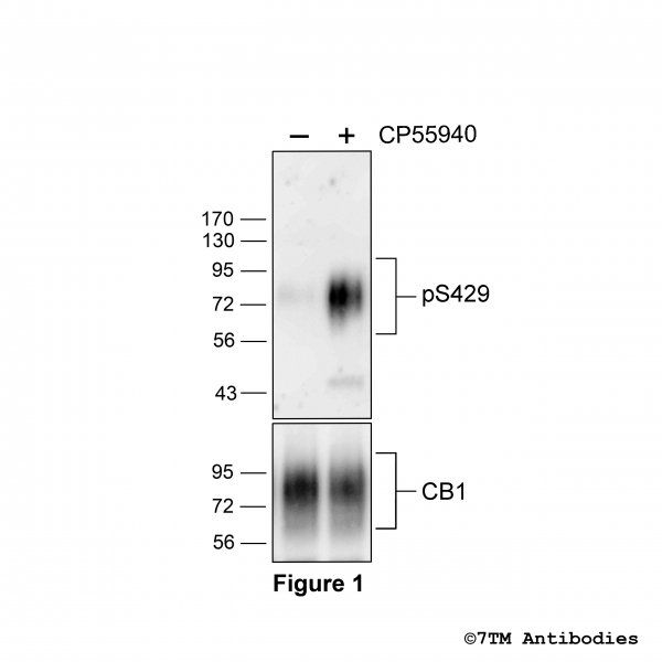 Agonist-induced Serine429 phosphorylation of the Cannabinoid Receptor 1