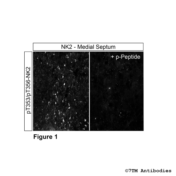  Immunohistochemical identification of Threonine353/Threonine356 phosphorylation of NK2 Receptor in Medial Septum