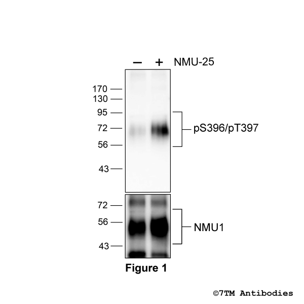 Agonist-induced Serine396/Threonine phosphorylation of the Neuromedin U Receptor 1