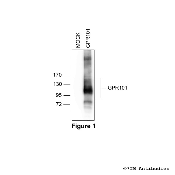 GPR101 (non-phospho), G protein-coupled Receptor 101 Antibody