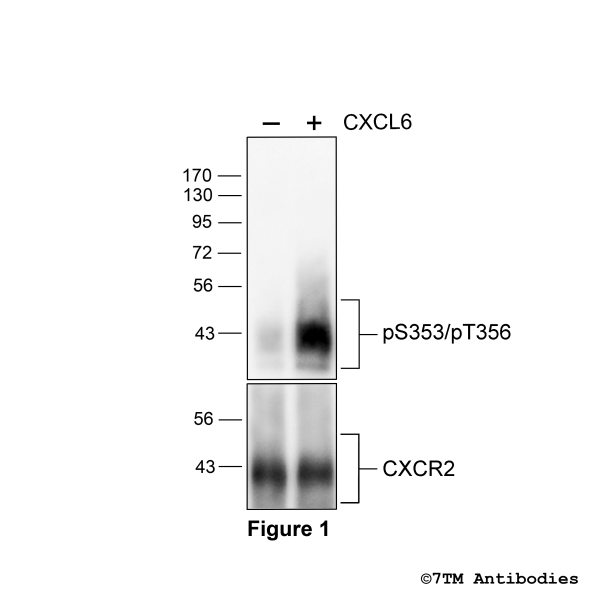 Agonist-induced Serine353/Threonine356 phosphorylation of the CXC Chemokine Receptor 2