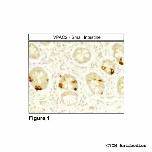 Immunohistochemical identification of VIP Receptor 2 in small intestine.