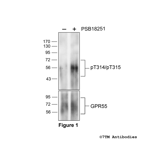 pT314/pT315-GPR55 (phospho-GPR55 Antibody)