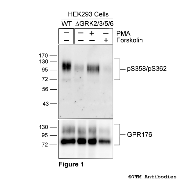 Serine358/Seine362 phosphorylation of the G-protein coupled Receptor 176.