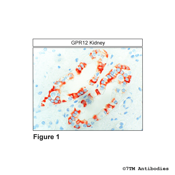 GPR12 (IHC-grade), G Protein-Coupled Receptor 12 Antibody