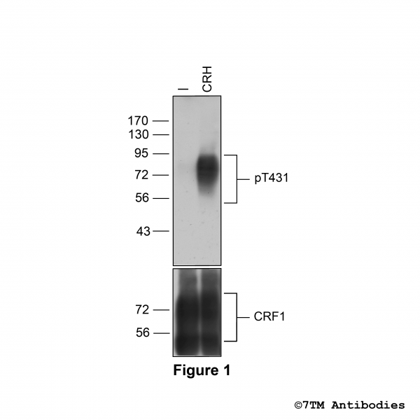 Agonist-induced Threonine431 phosphorylation of CRF1 Receptor