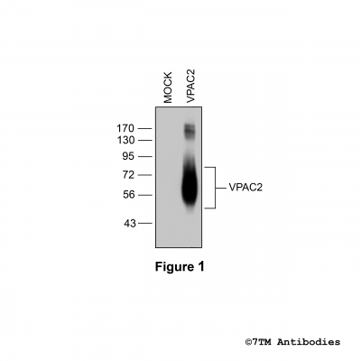 VIP/PACAP Receptor Antibodies | 7TM Antibodies®