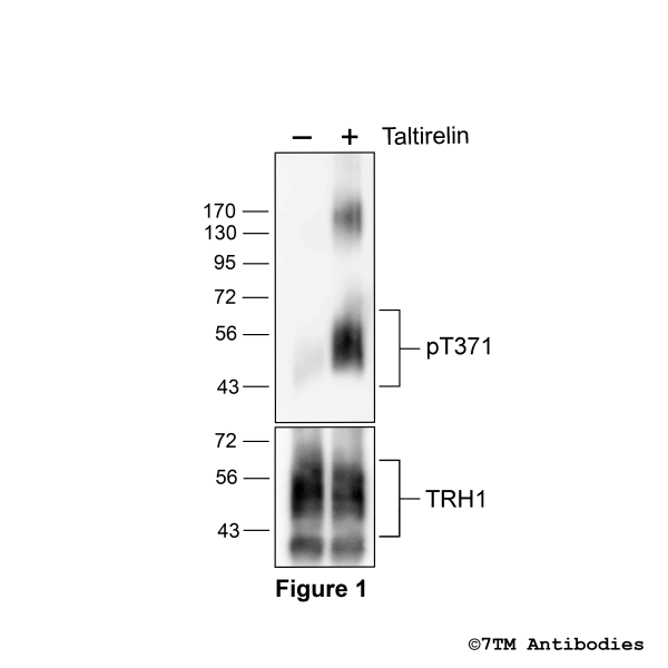 Agonist-induced Threonine371 phosphorylation of the TRH1-Receptor