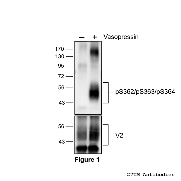 Agonist-induced Serine362/Serine363/Serine364 phosphorylation of the Vasopressin Receptor 2