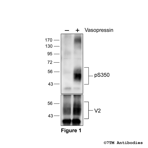 Agonist-induced Serine350 phosphorylation of the Vasopressin Receptor 2