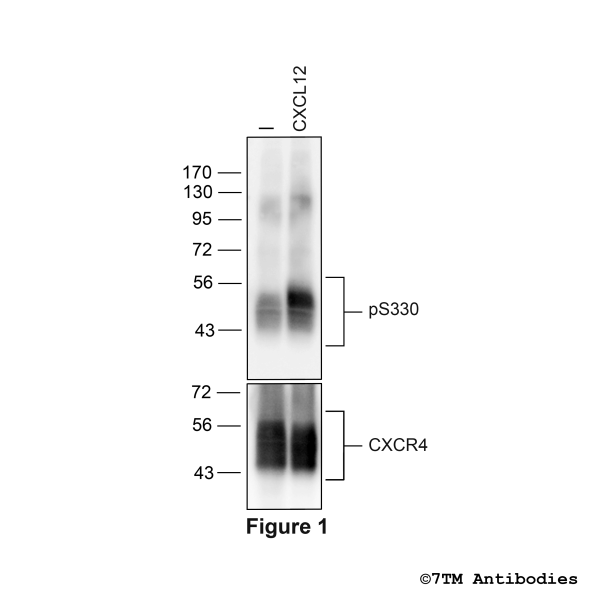  Agonist-induced Serine330 phosphorylation of the CXC Chemokine Receptor 4