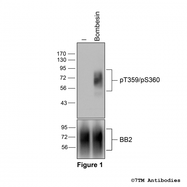Agonist-induced Threonine359/Serine360 phosphorylation of the Bombesin Receptor 2