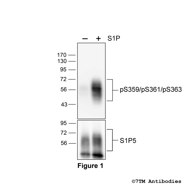 Agonist-induced Serine359/Serine361/Serine363 phosphorylation of the Sphingosine 1-Phosphate Receptor 5