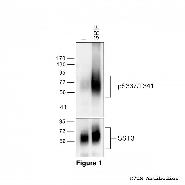 pS337/pT341-SST3 (phospho-Somatostatin Receptor 3 Antibody)