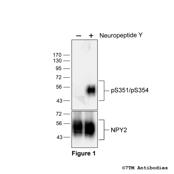 Agonist-induced Serine351/Serine354 phosphorylation of the Neuropeptide Y
