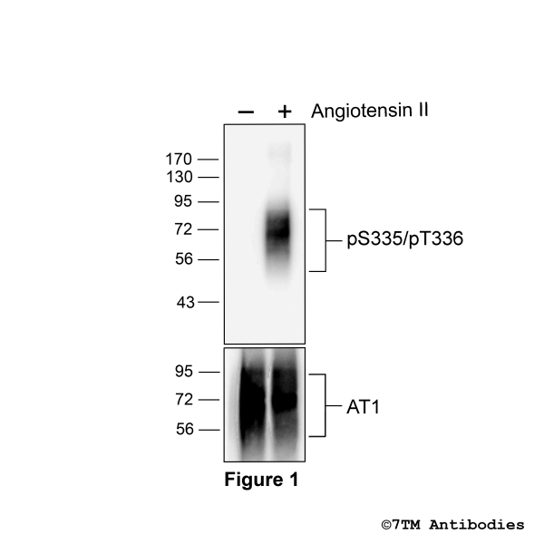 Agonist-induced Serine335/Threonine336 phosphorylation of the Angiotensin Receptor 1