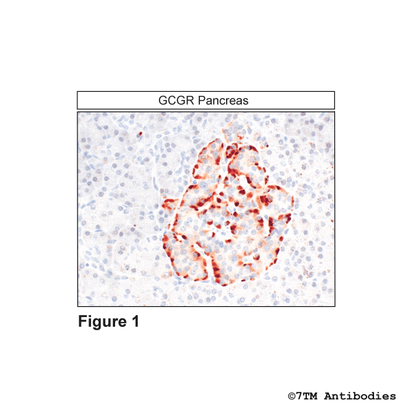 GCGR (IHC-grade), Glucagon Receptor Antibody