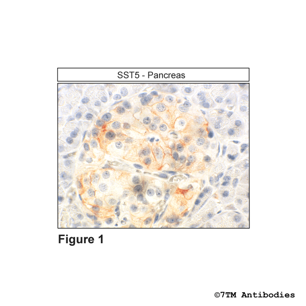 SST5 (IHC-grade), Somatostatin Receptor 5 Antibody