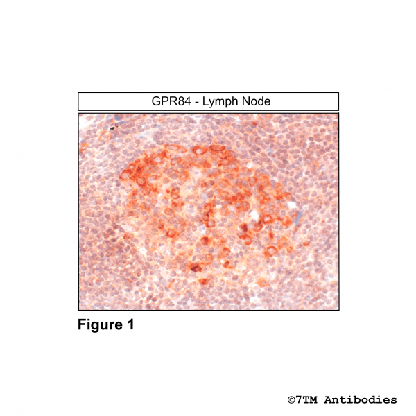 Immunohistochemical identification of G Protein-coupled Receptor 84 in lymph node