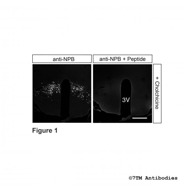 Immunohistochemical identification of Neuropeptide B (NPB) in rat hypothalamus