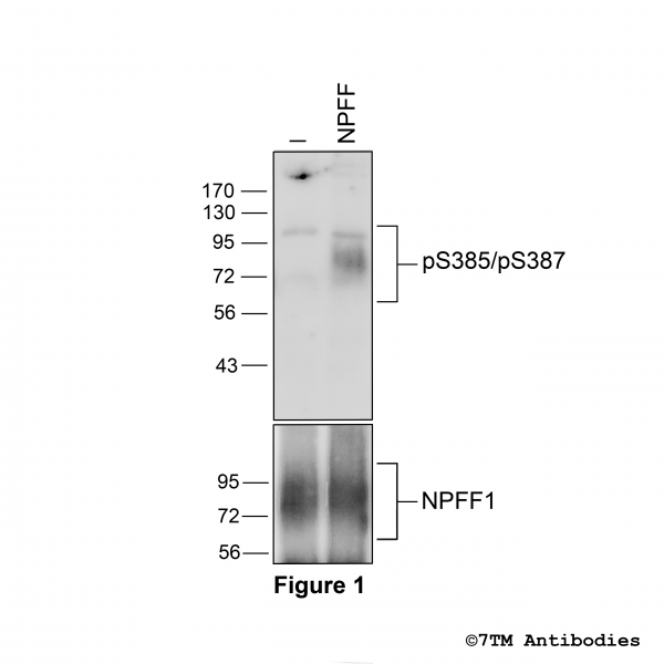 Agonist-induced Serine385/Serine387 phosphorylation of the Neuropeptide Receptor 1
