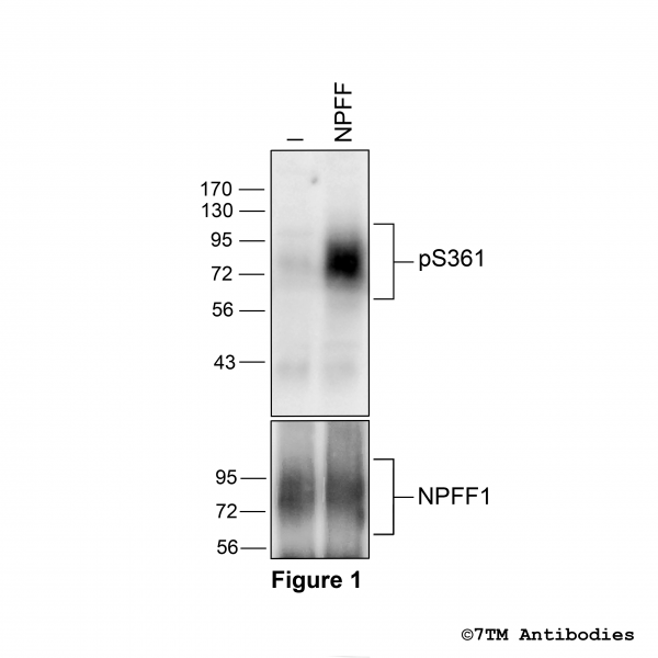 Agonist-induced Serine361 phosphorylation of the Neuropeptide FF Receptor 1