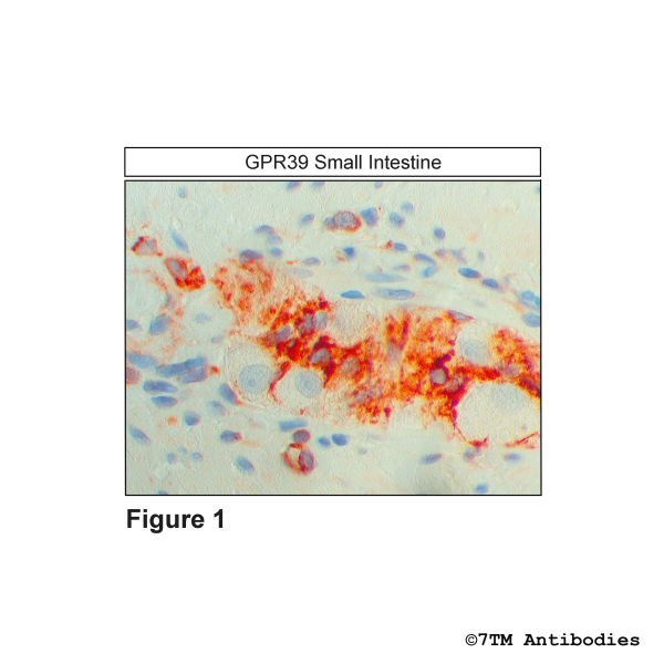 GPR39 (IHC-grade), G Protein-Coupled Receptor 39 Antibody