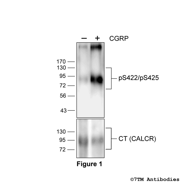 Agonist-induced Serine422/Serine425 phosphorylation of the Calcitonin Recepto