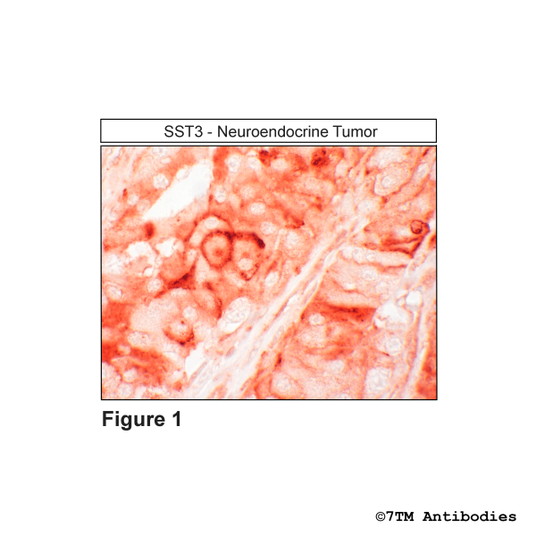SST3 (IHC-grade), Somatostatin Receptor 3 Antibody